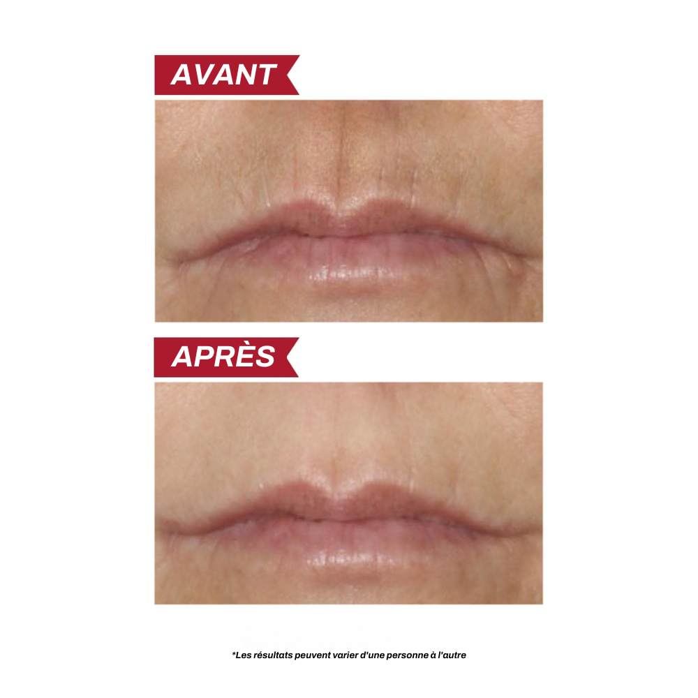 Correcteur Pro Contours des Lèvres Soin Anti-Âge Périoral